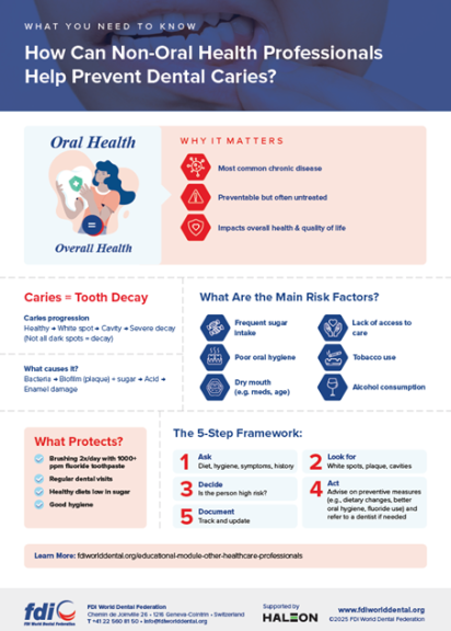 Understanding Dental Caries Infographic